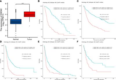 EDEM2 is a diagnostic and prognostic biomarker and associated with immune infiltration in glioma: A comprehensive analysis